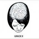 , Help for Hair Loss